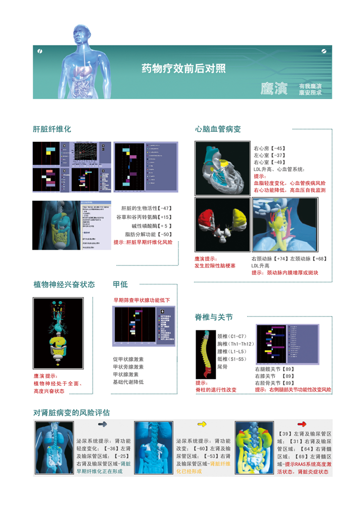 糖尿病早期無創檢測儀