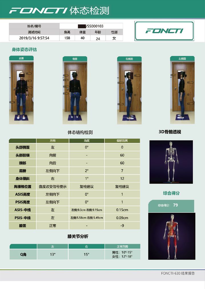 foncti-630產品報告