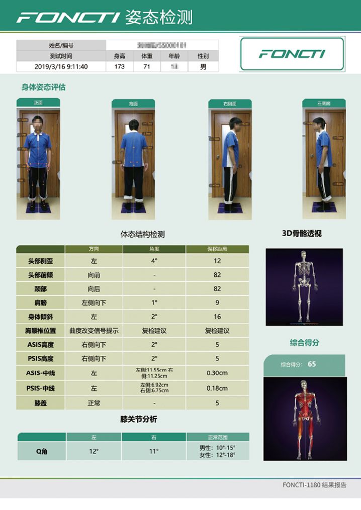 步態分析系統產品報告
