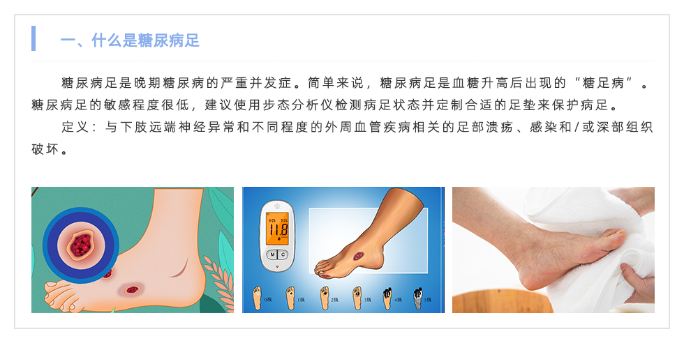 步態分析儀
