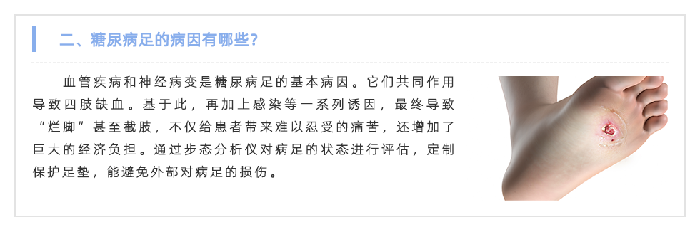 步態分析儀
