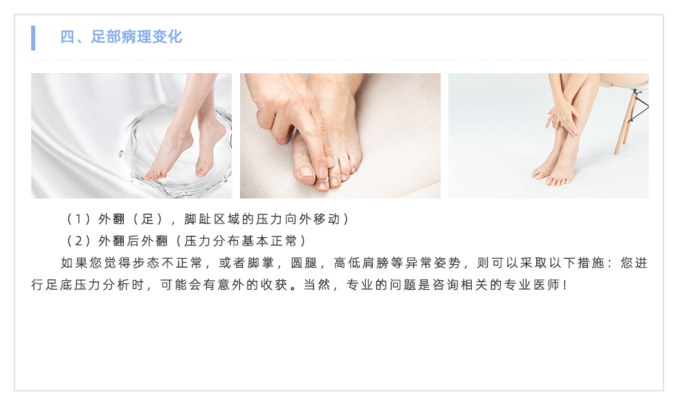 足底壓力分析系統