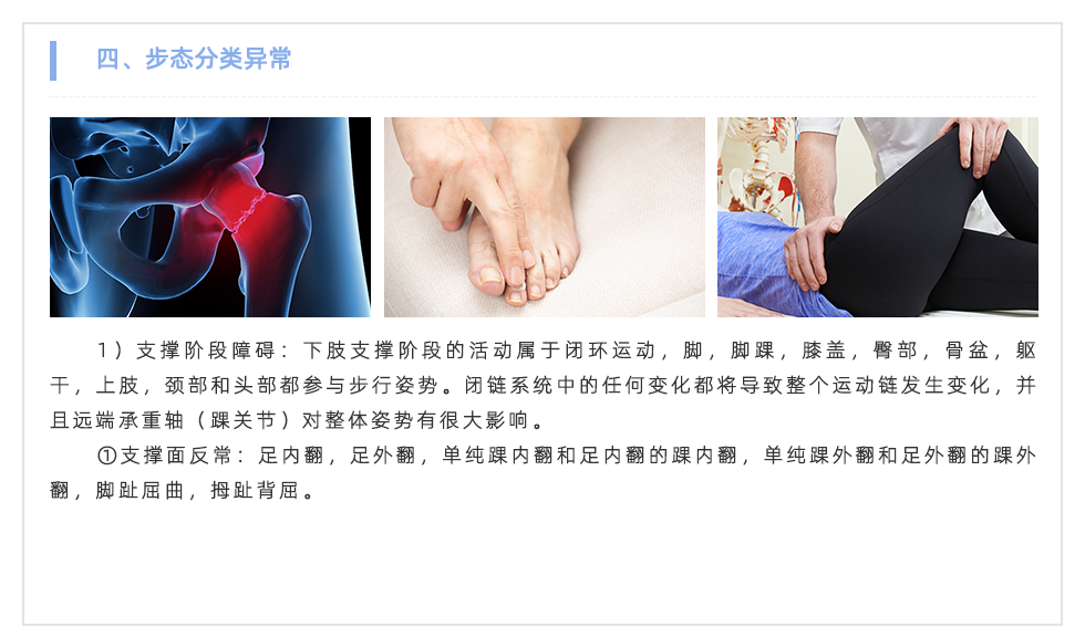步態分析設備