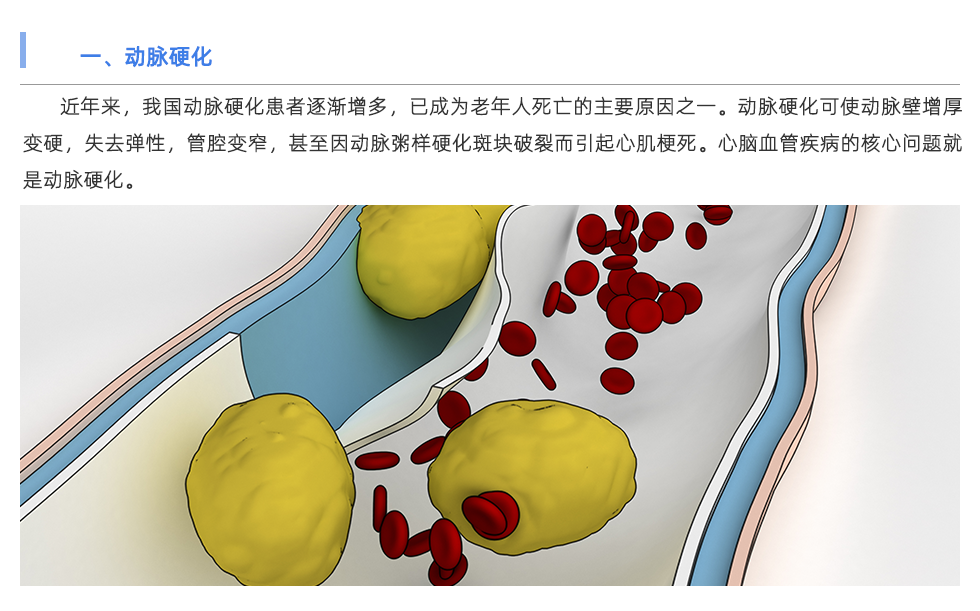 動(dòng)脈硬化檢測(cè)儀