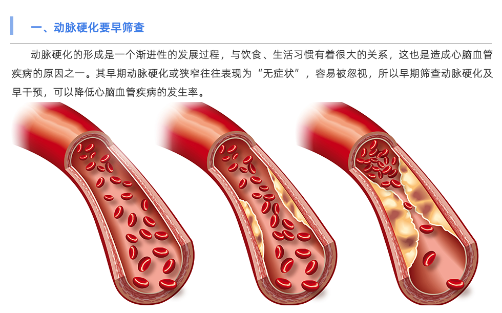 動脈硬化檢測儀