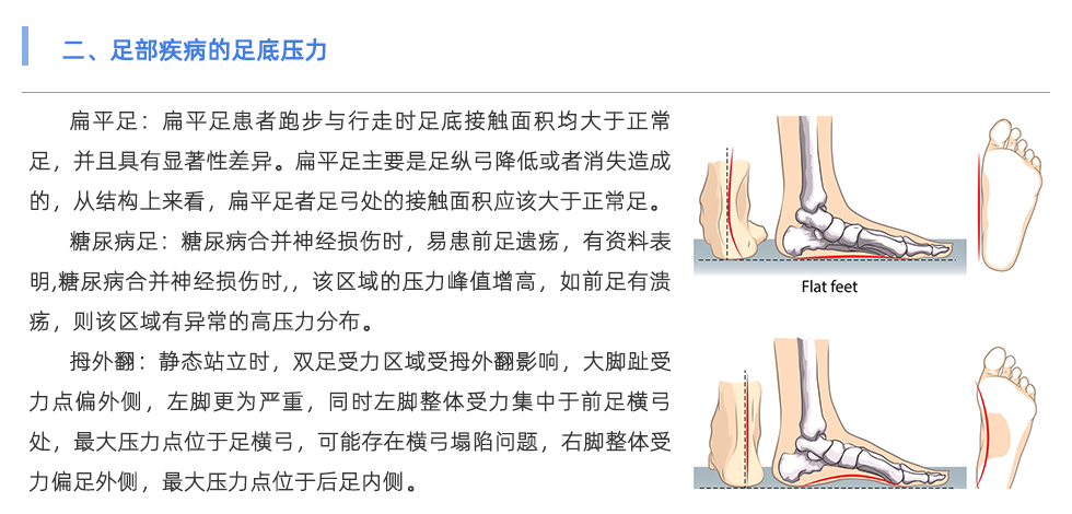 足底壓力分析系統