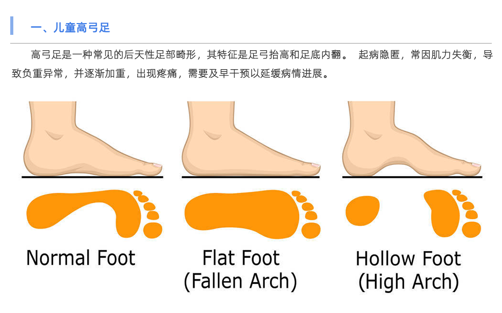 步態分析儀