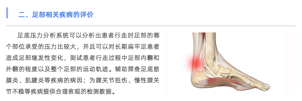 足底壓力分析系統