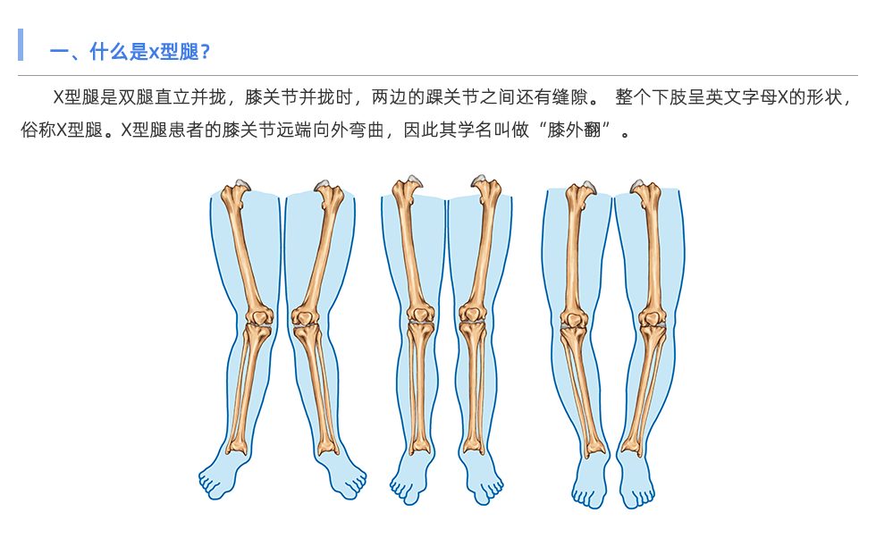 步態分析儀