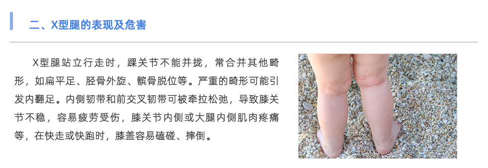 步態分析儀