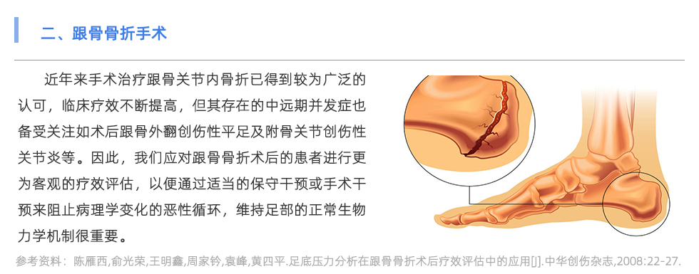 足底壓力分析系統