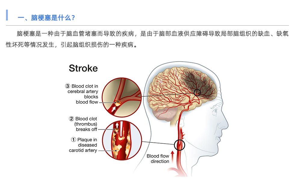 動脈硬化檢測儀