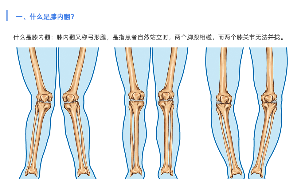 步態分析儀