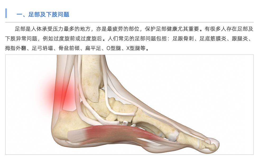 步態分析儀