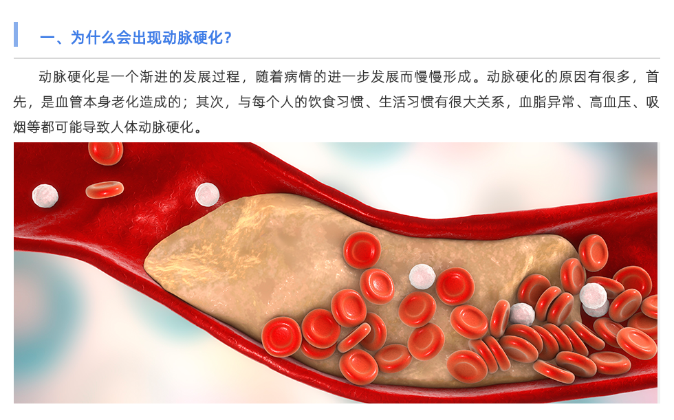 動(dòng)脈硬化分析儀