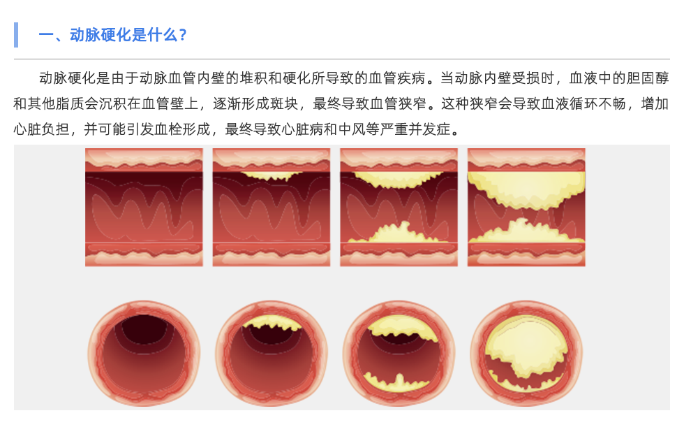 動脈硬化分析儀